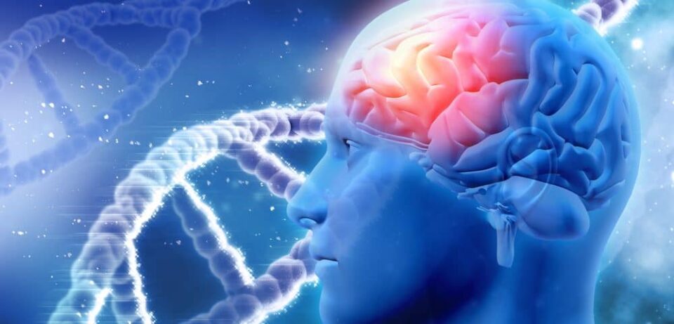 parkinson