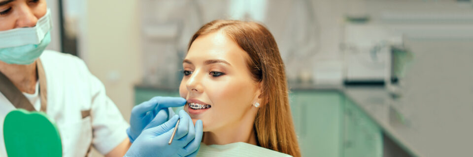 apparecchio denti