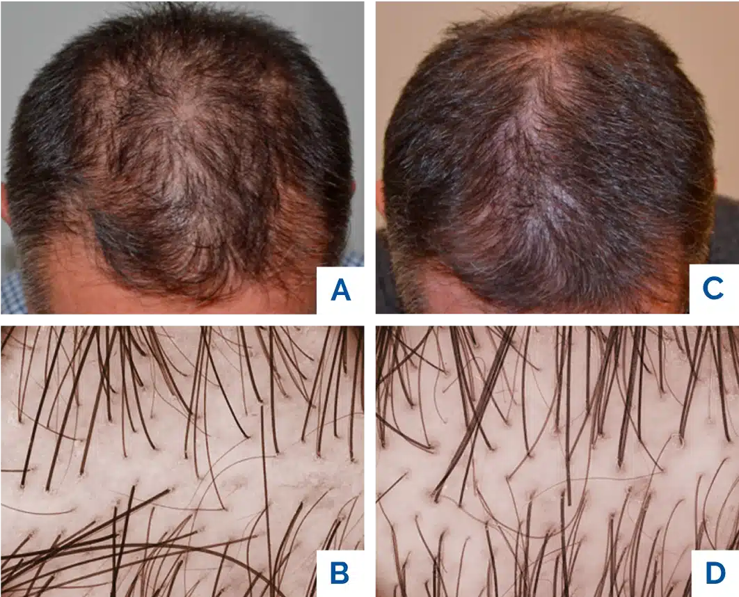 capelli roma