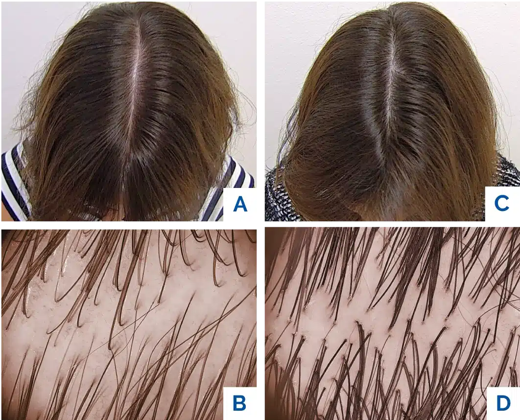 capelli roma